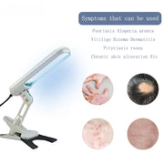 UVB Phototherapy Narrow 311nm UV Phototherapy Lamp Uvb Light Therapy Vitiligo For Psoriasis