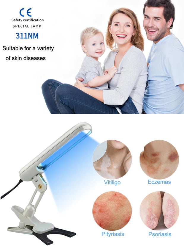 UVB Phototherapy Narrow 311nm UV Phototherapy Lamp Uvb Light Therapy Vitiligo For Psoriasis